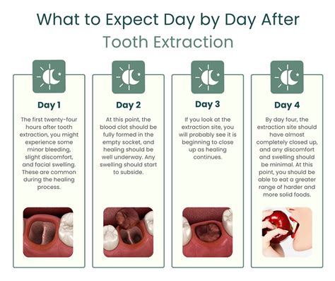 Navigating Tooth Extraction Cost Recovery Time: What to Expect and Tips for Faster Healing