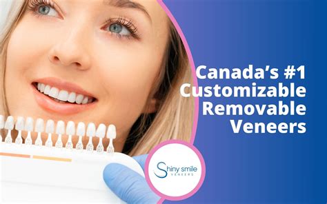 Veneers for Teeth Canada: Transform Smiles!