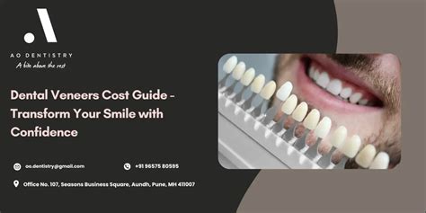 Veneers for Teeth Cost in London: Top Insights