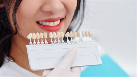 Veneers for Teeth Singapore: Transform Your Smile!
