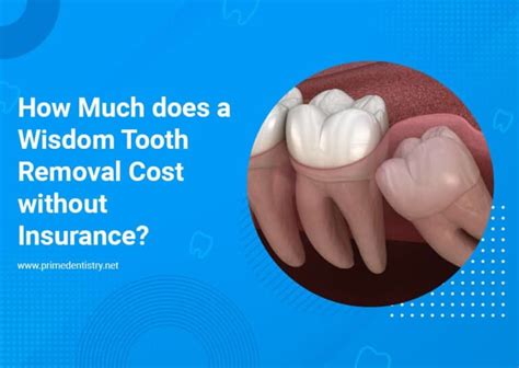 Wisdom Tooth Removal Insurance Coverage: Get the Facts